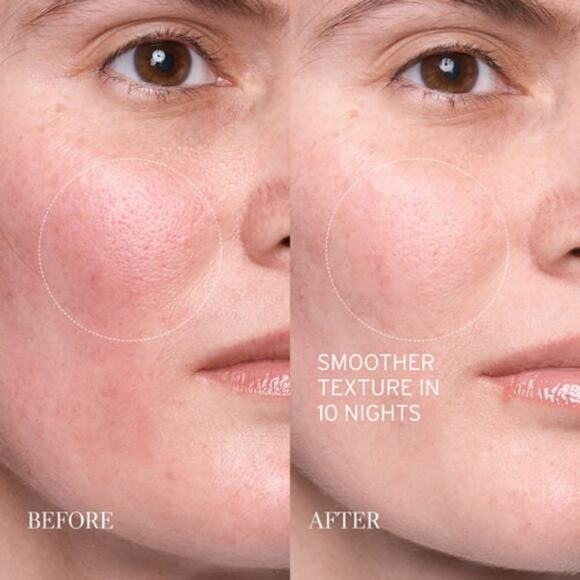 Fresh Lotus Youth Preserve Resurfacing Dream Serum - Picture 2 of 8